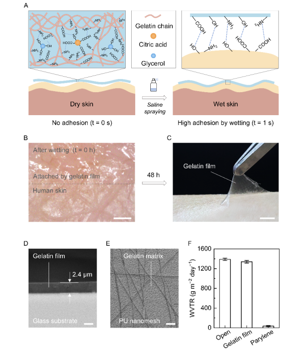 广东以色列理工学院王燕教授：生理盐水触发黏附的超薄透气明胶膜，于无线睡眠和心脏健康监测